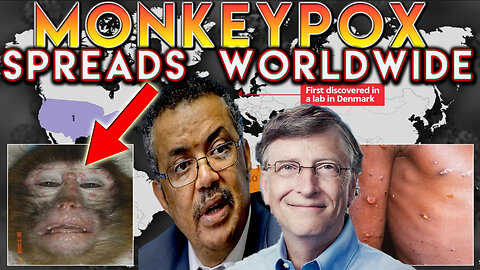 Monkeypox Outbreak 2024: Worldwide Emergency Unfolds! #monkeypoxvaccine #pandemic