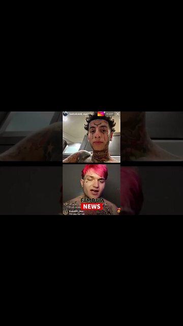 Who Is WyeZy? The NEW Island Boy with Down Syndrome? #Shorts