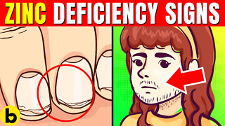 16 Signs & Symptoms Of Zinc Deficiency