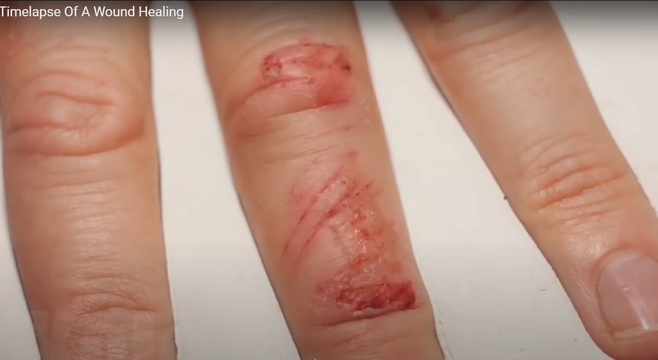 Timelapse Of A Wound Healing