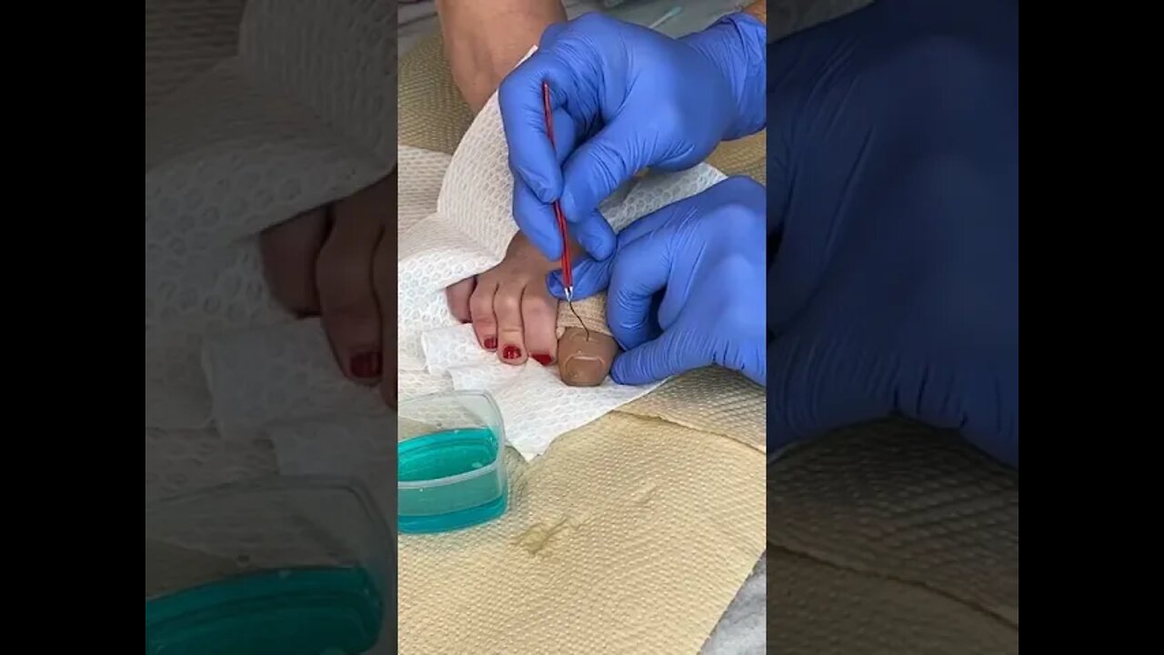 That came out of her TOE !