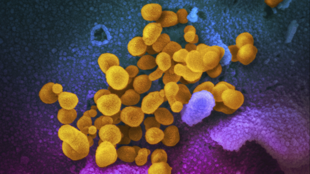 CDC Warns Doctors To Look Out For COVID-Related Syndrome In Kids