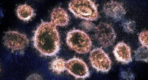 Vaccine Vials Examined: HORRIFIC Findings!
