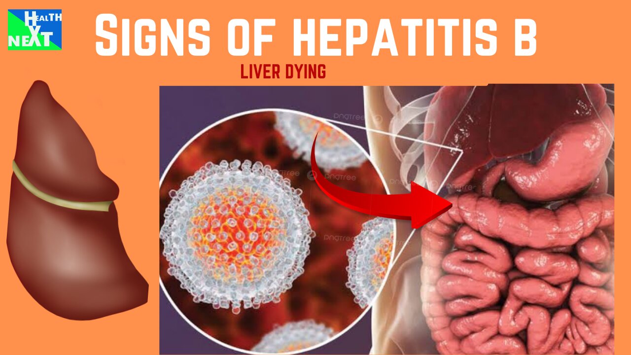 COMMON EARLY SIGNS OF HEPATITIS B/DEADLY LIVER DISEASE