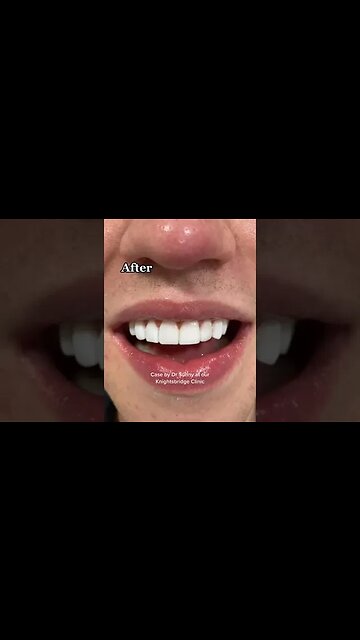 Dental And Teeth Hygiene