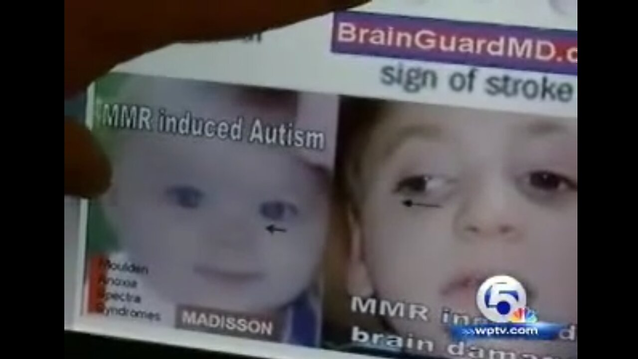 Vaccines & Children's Brain Damage Proved. - commonagenet - 2010