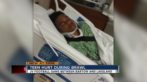 Bartow High School football player remains hospitalized after brawl between rival teams during game