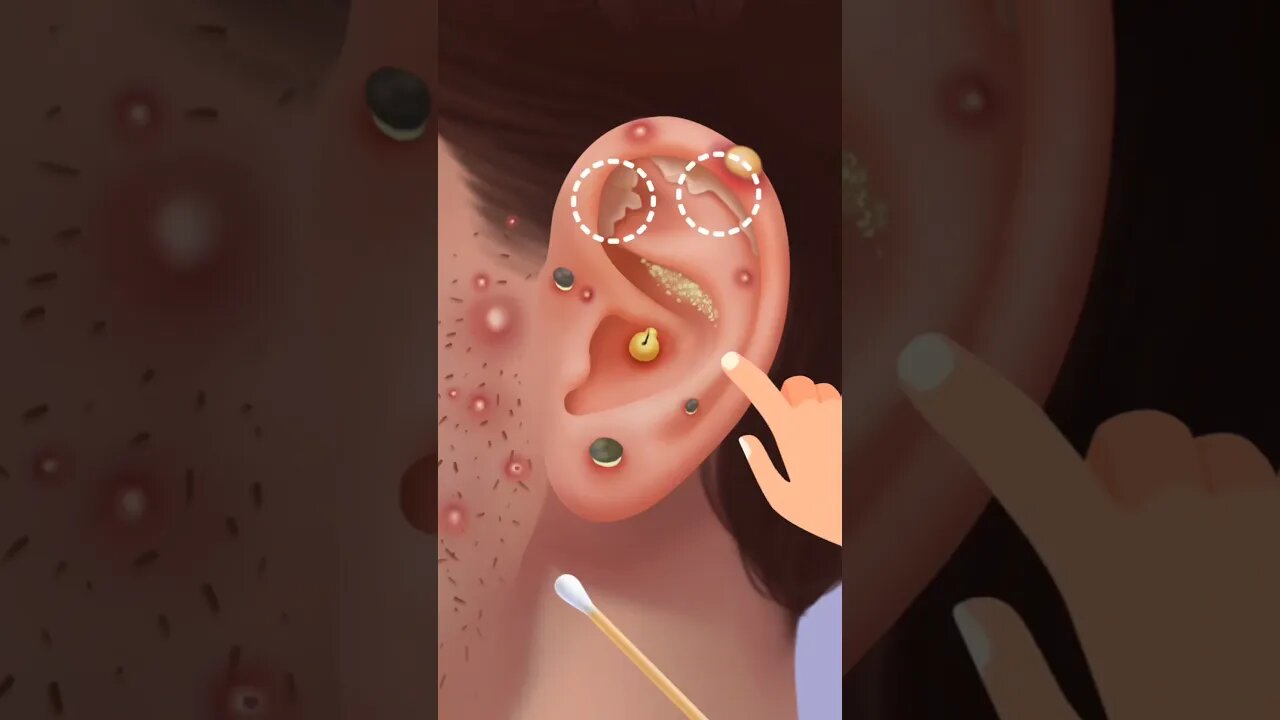 ASMR EAR DEEP CLEANING#animation #viralvideo #short #asmr