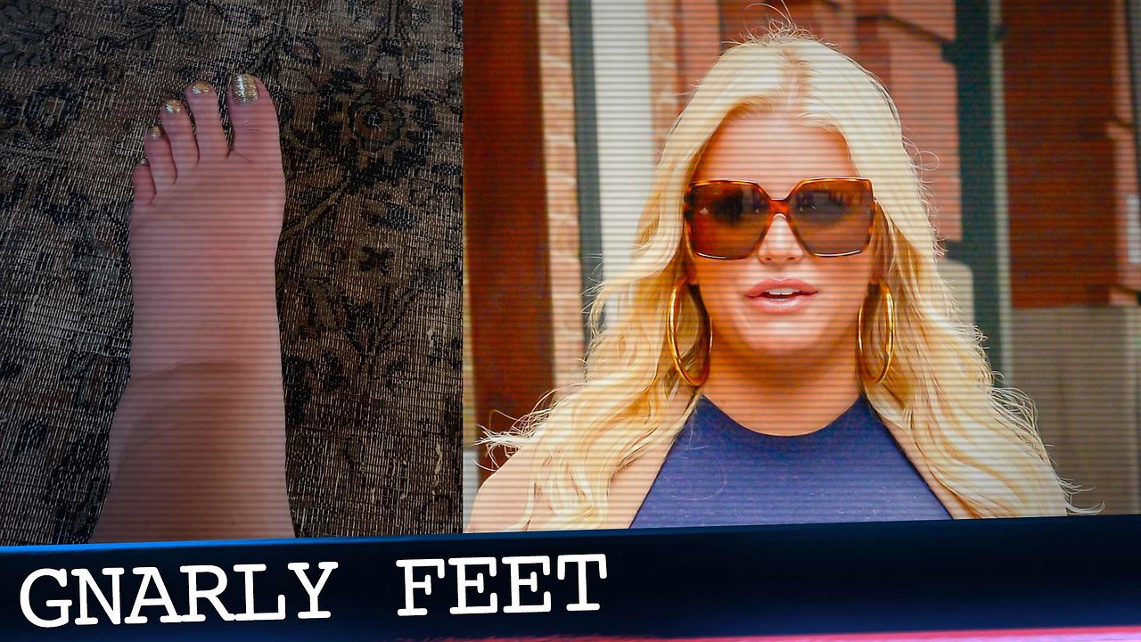 Pregnant Jessica Simpson Needs Help for Her Gnarly Swollen Feet