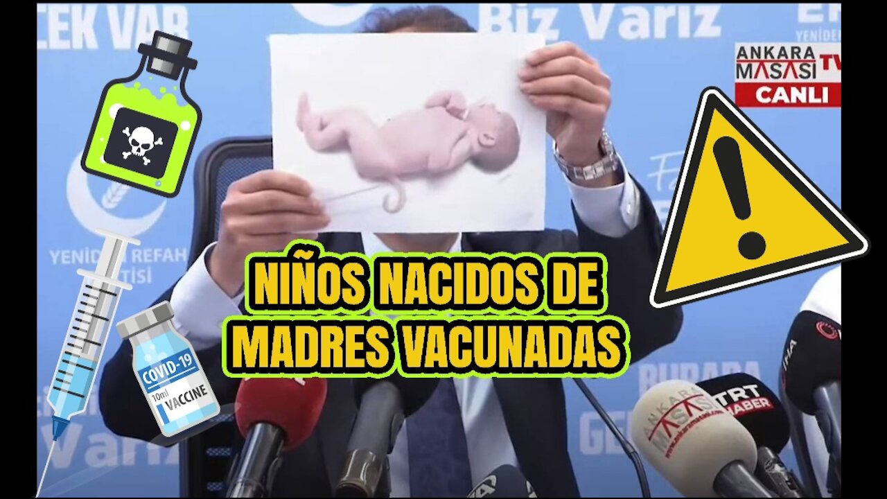 Niños de madres vacunadas nacen con malformaciones