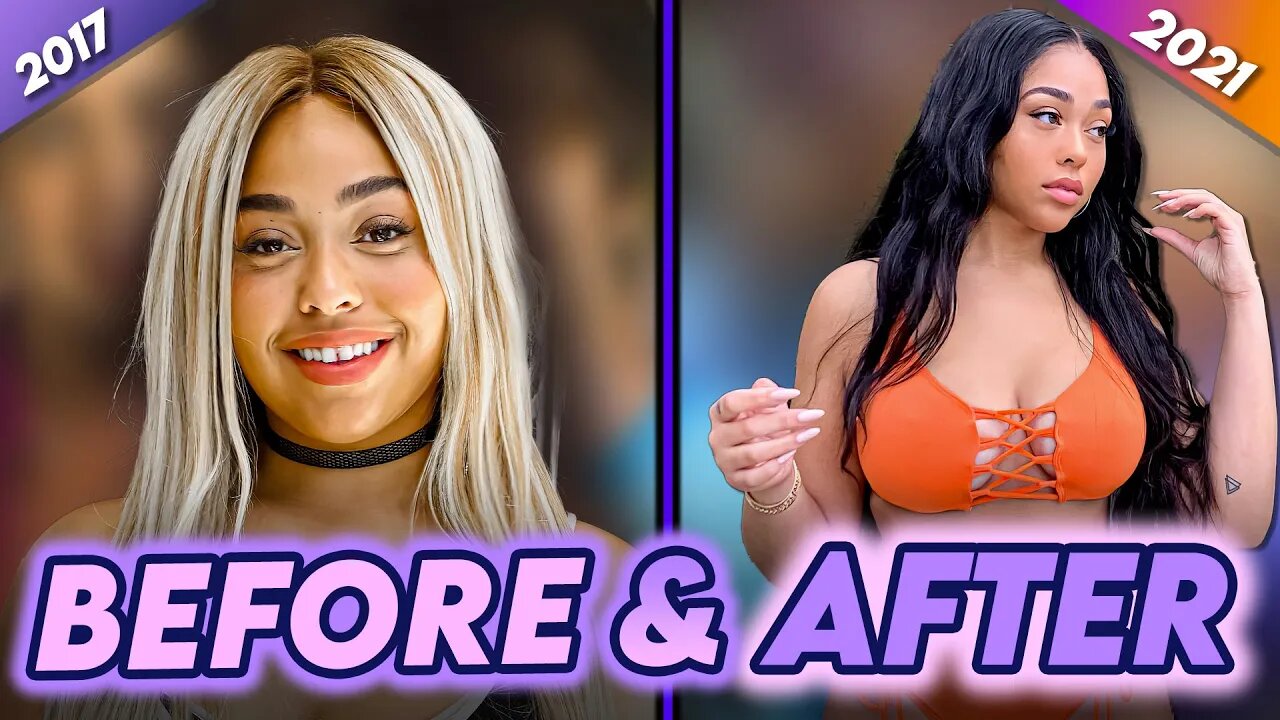 Jordyn Woods | Before & After | Liposuction, BBL & More