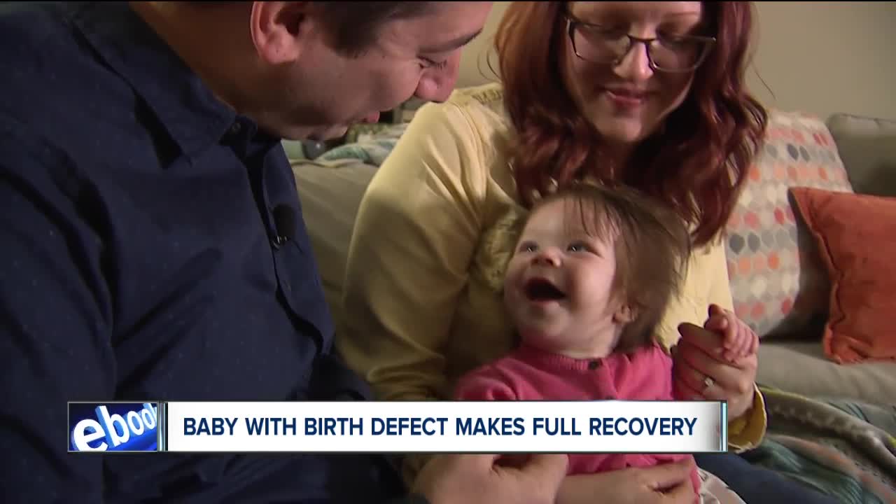 Cleveland Clinic doctors operate on 4-day old baby diagnosed with rare birth defect