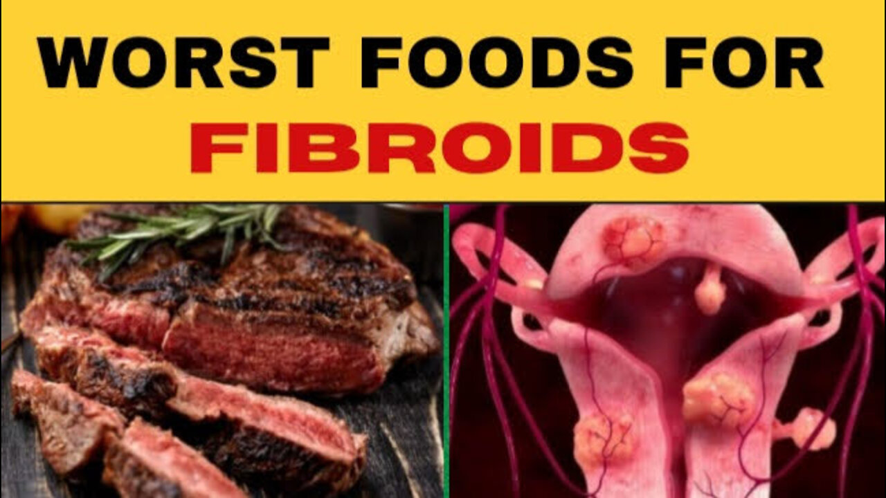 Worst Foods for Fibroids