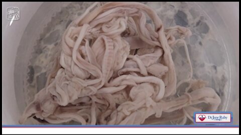 UPDATE. Stringy Clots: Scientists Weighing in From All Over the World