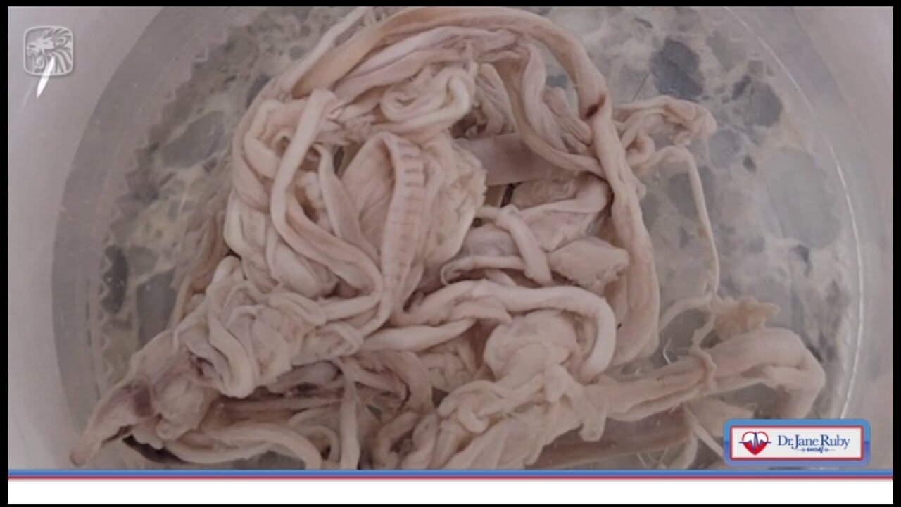 UPDATE. Stringy Clots: Scientists Weighing in From All Over the World