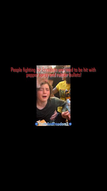21-08-2021 Kid sprayed with pepper spray by Satanic Nazi police! Brave Kid!