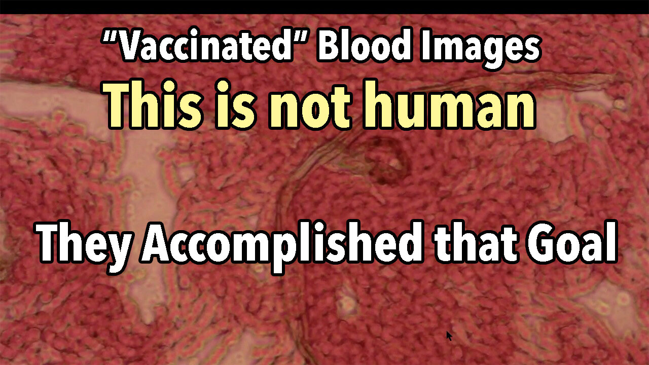 More "vaccinated" blood images: Accomplished Goal to Change what is Human w/ Maryam Henein