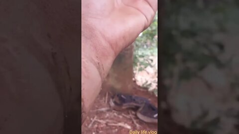 tai nạn đứt cổ tay đứt hết gân mạch máu