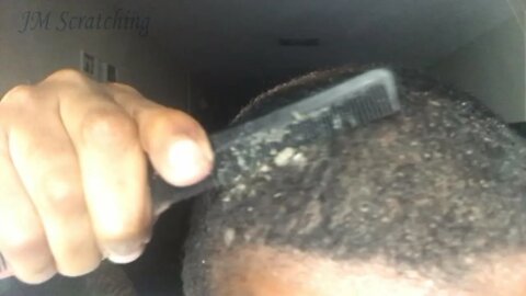 Dandruff Scratching with Oil