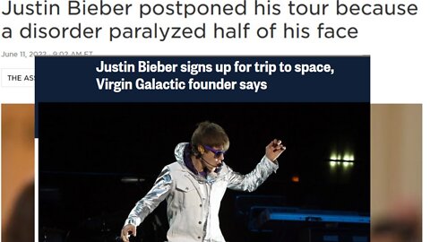 Vaccine or Virus : Justin Bieber's Condition & Obvious Origins