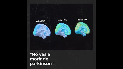 ¿Cómo reaccionarias al ser diagnosticado con párkinson?