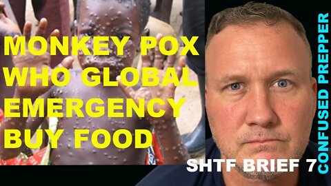 MONKEYPOX LOCKDOWNS WHO GLOBAL EMERGENCY SHTF BRIEF 7