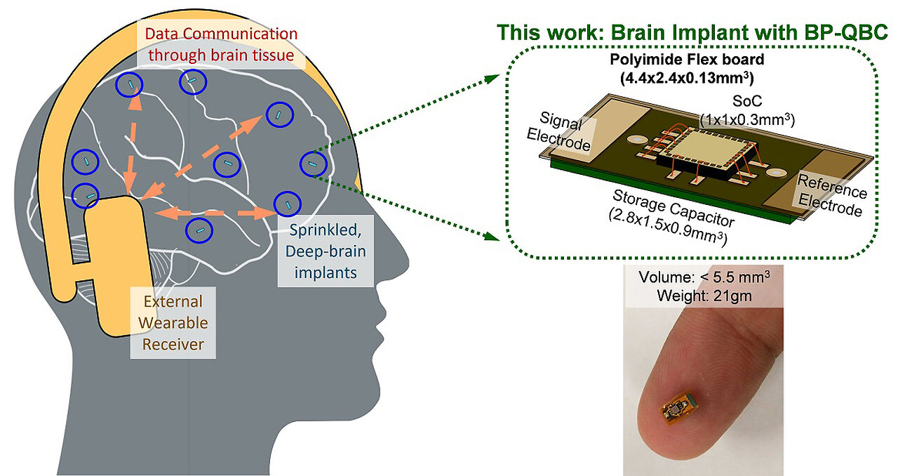 (MOTB) New wireless brain implants could bring mind control to new level