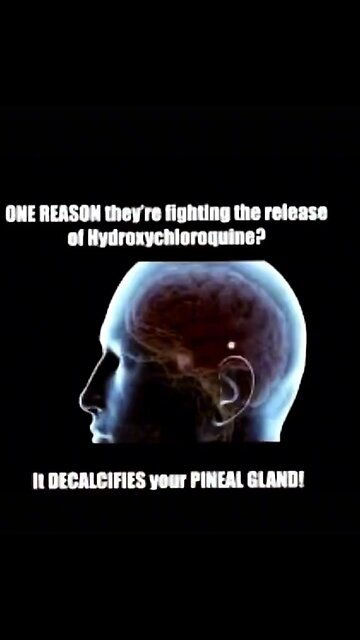 Un calcify the pineal gland