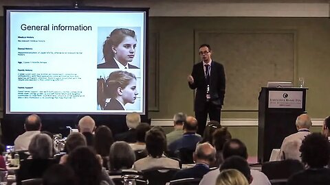 Orthotropics Case Study, Adult Orthotropics, Midface Retraction & Facial Growth | Dr. Mike Mew