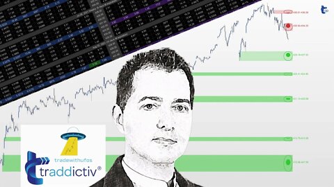 Strategy Trading REPLAY - OPTIONS | 2022 May-5