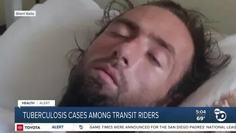 Second San Diego County transit rider tests positive for tuberculosis