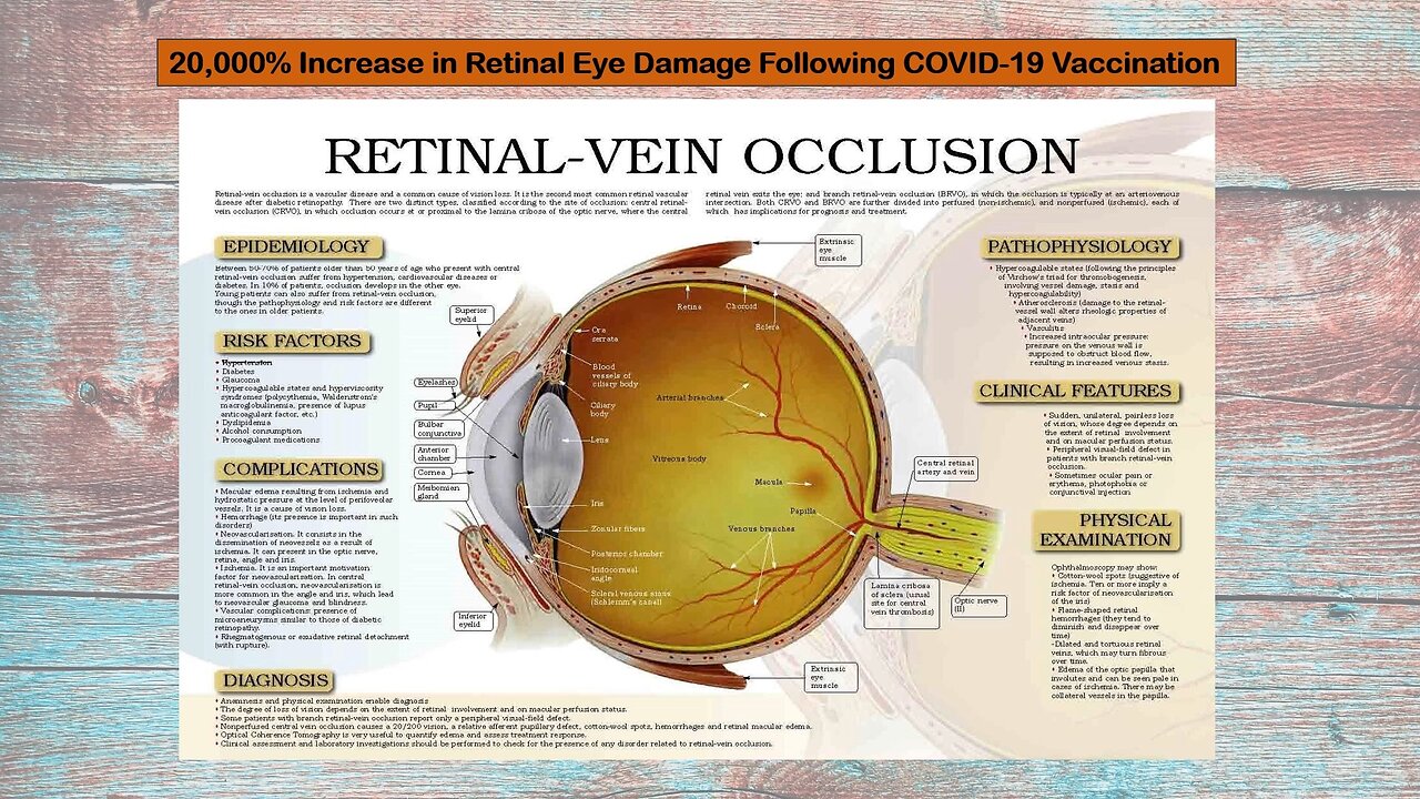 20,000% Increase in Retinal Eye Damage Following the Thingy