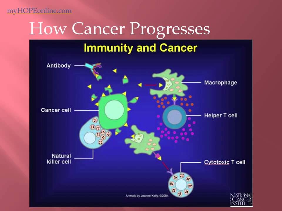 Cancer Class 2 DIET - Dr. Kevin Conners