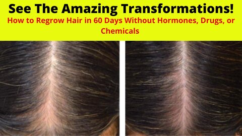 How to Regrow Hair in 60 Days