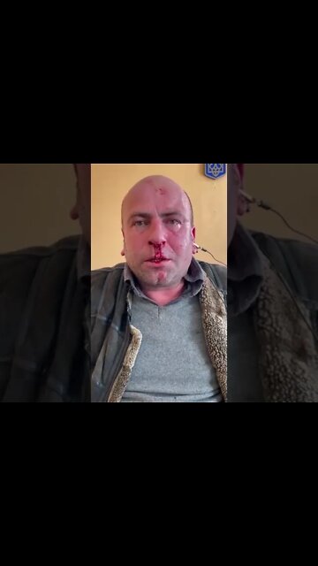 🔞🔴 Рашисти - садисти катують струмом мирного жителя Херсонщини, фіксуючи свої злочини на камеру.