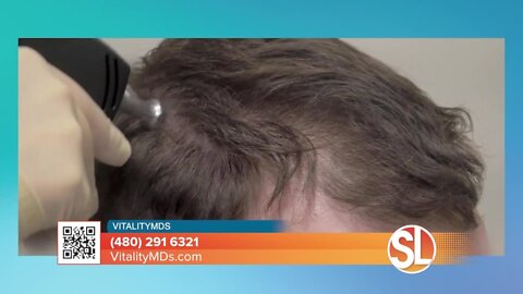 Hiding your hair loss? VitalityMDs offers the latest in hair treatment technology with Alma TED