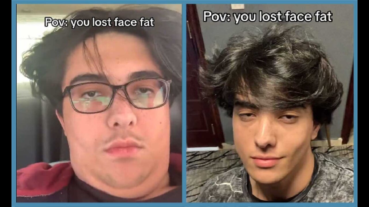 weight loss transformation, Face Fat