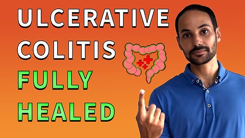 Ulcerative Colitis Fully Healed