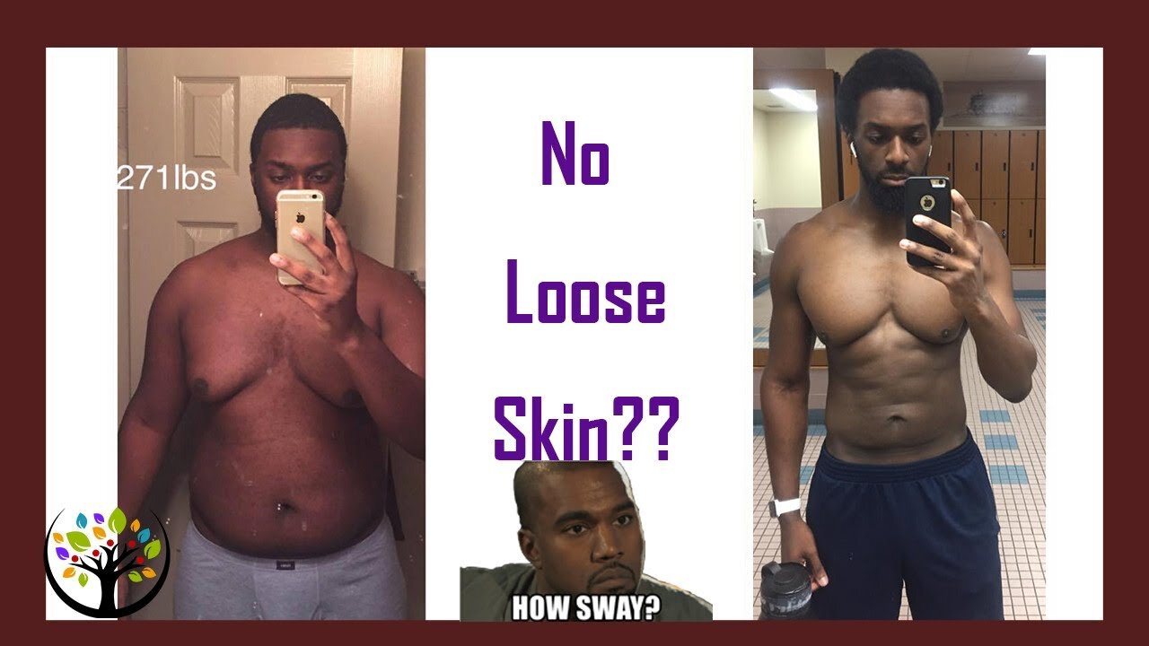 How To Lose A Ton Of Weight With No Loose Skin