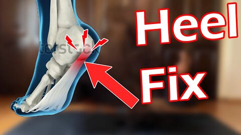 Fix Heel Pain (Plantar Fasciitis)