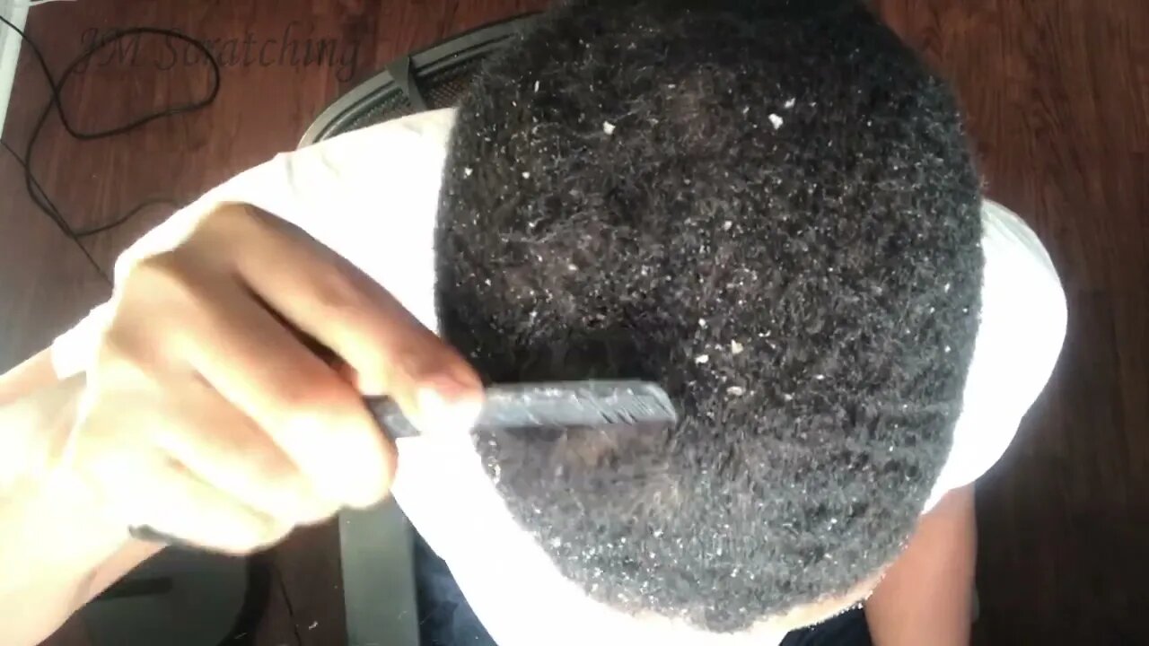 Dandruff Scratching in the Sun