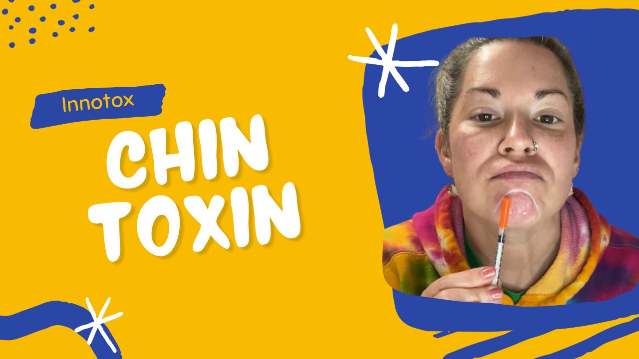 Chin Botox using Innotox