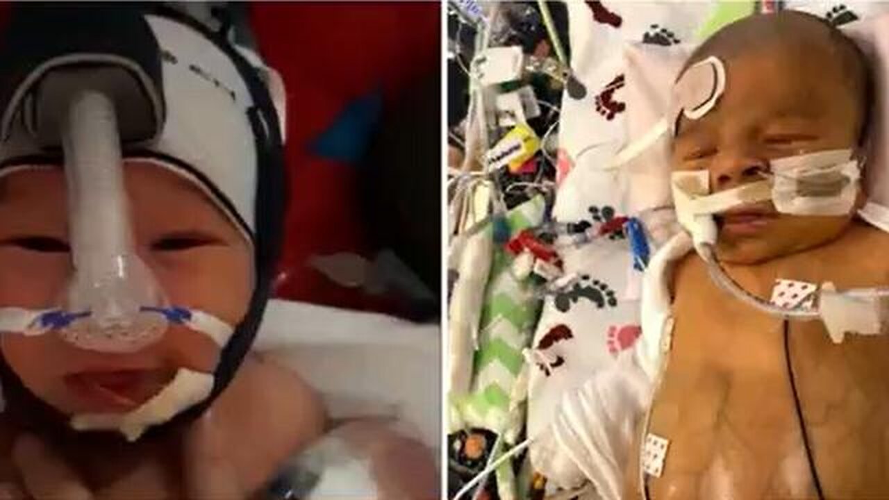 Baby Has Died of Blood Clot after Vaccinated Blood Transfusion - Against Parents Wishes