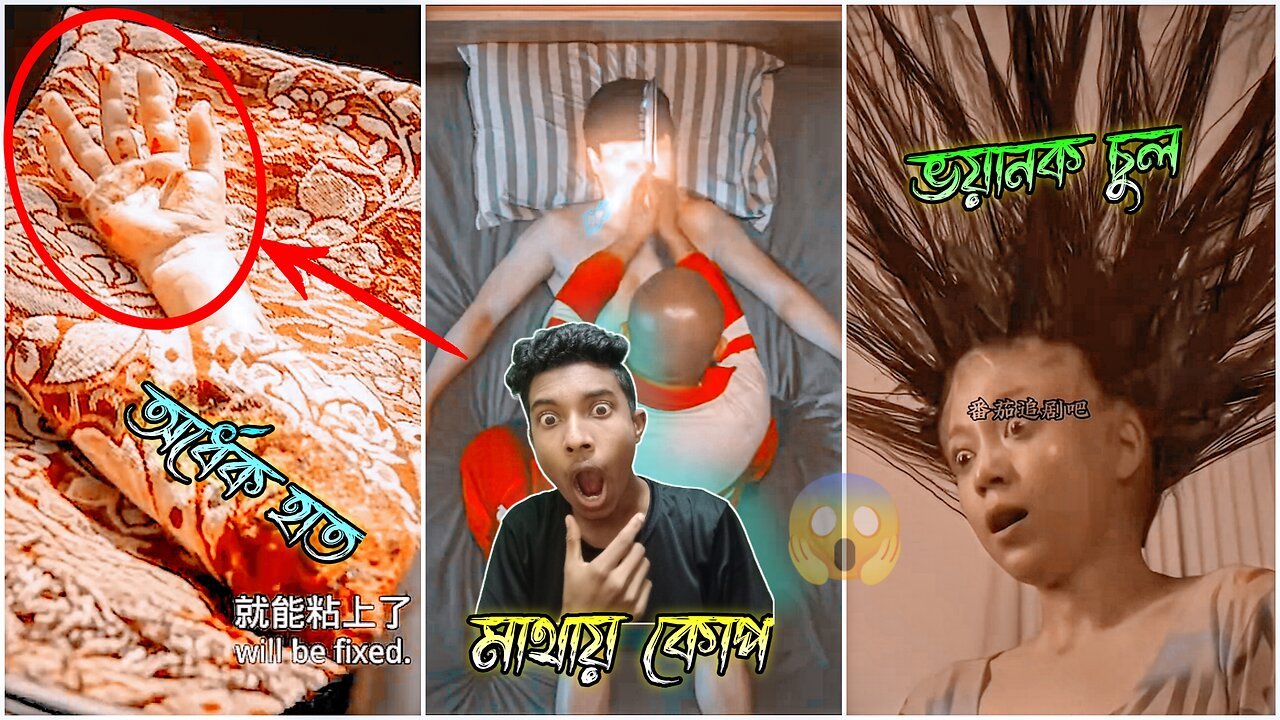 ছোট বাচ্চাটির হাত দু’টুকরো হয়ে গেলো 😓 | অজানা আজব কিছু ভিডিও | TOP 5 FACTS 2024 | mr creative 2.0