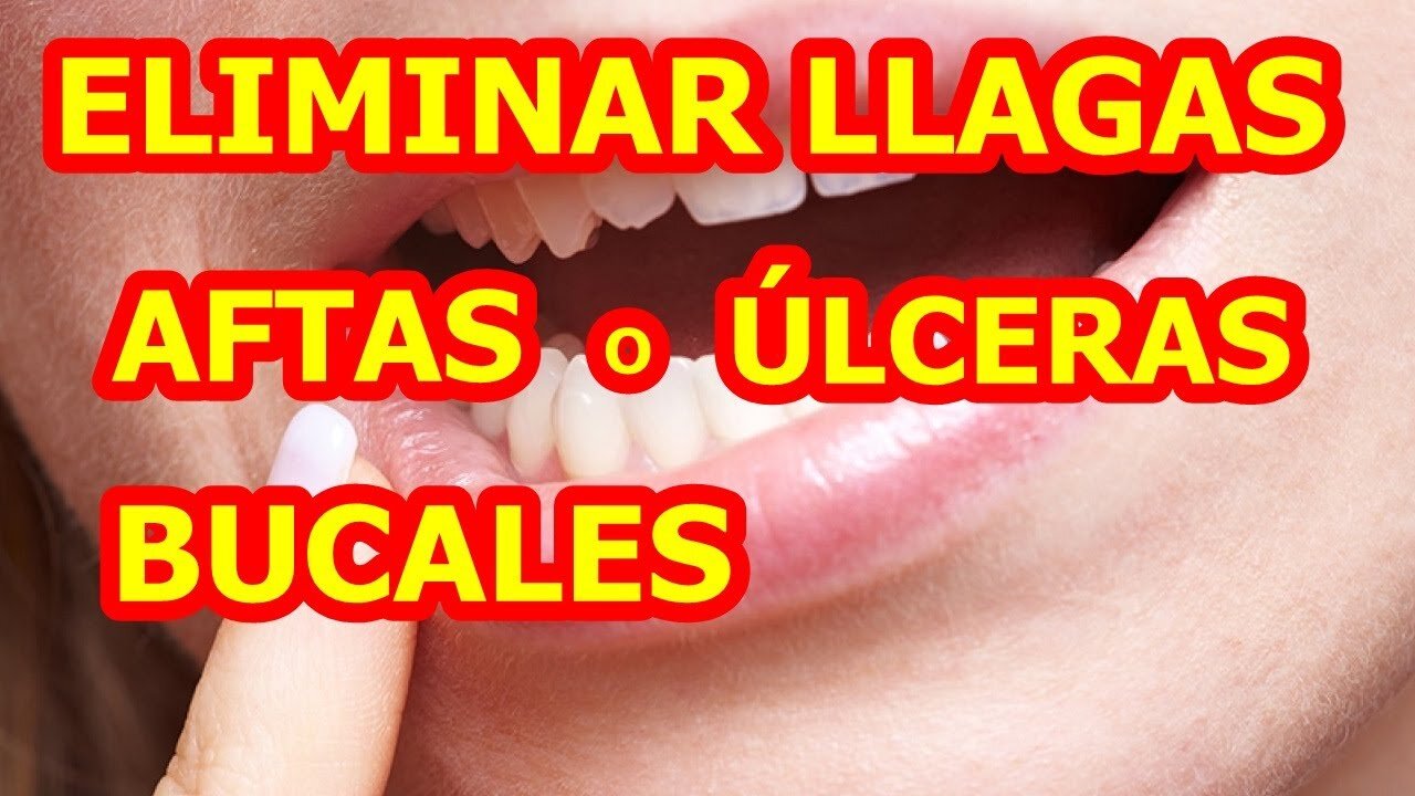 BINAURAL PARA LLAGAS, ULCERAS O AFTAS EN LA BOCA, CAUSA EMOCIONAL