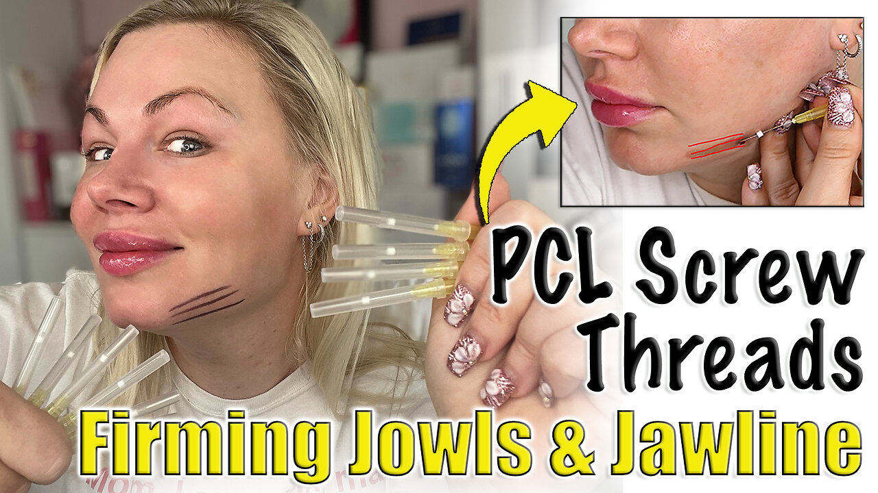 Tighten Jowls with PCL Screw Threads! AceCosm | Code Jessica10 saves you Money $$$