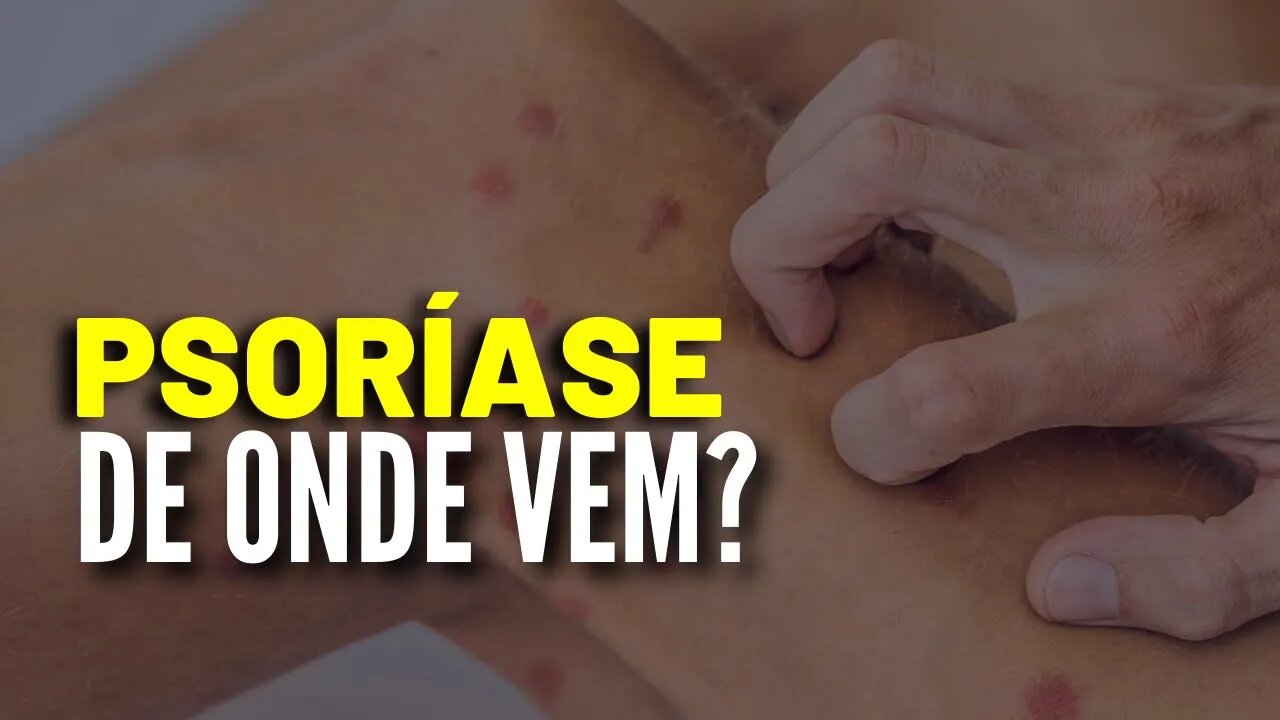 Psoríase - De Onde Vem a Psoríase