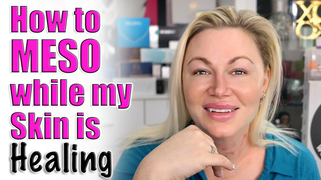 How to MESO While your Skin is Healing | Code Jessica10 saves you Money at All Approved Vendors