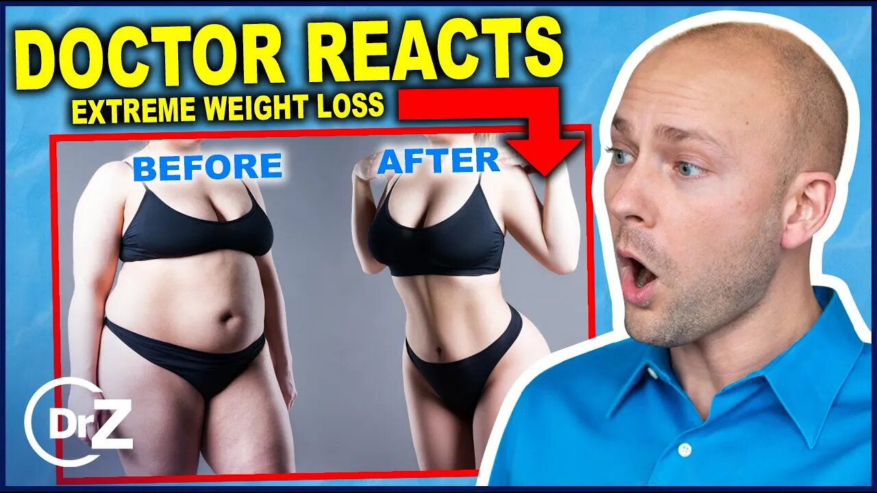 DOCTOR REACTS to CRAZY Weight Loss TRANSFORMATIONS!