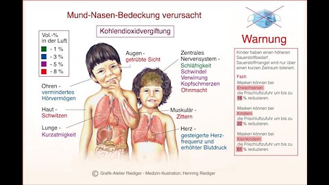 SCA 30 Unter der Lupe